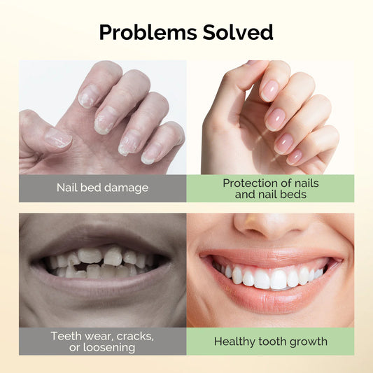 Nail Biting Treatment 15ml for Healthy Nails